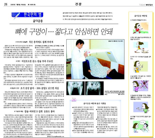 골다공증-(부산일보_2005.7.5)